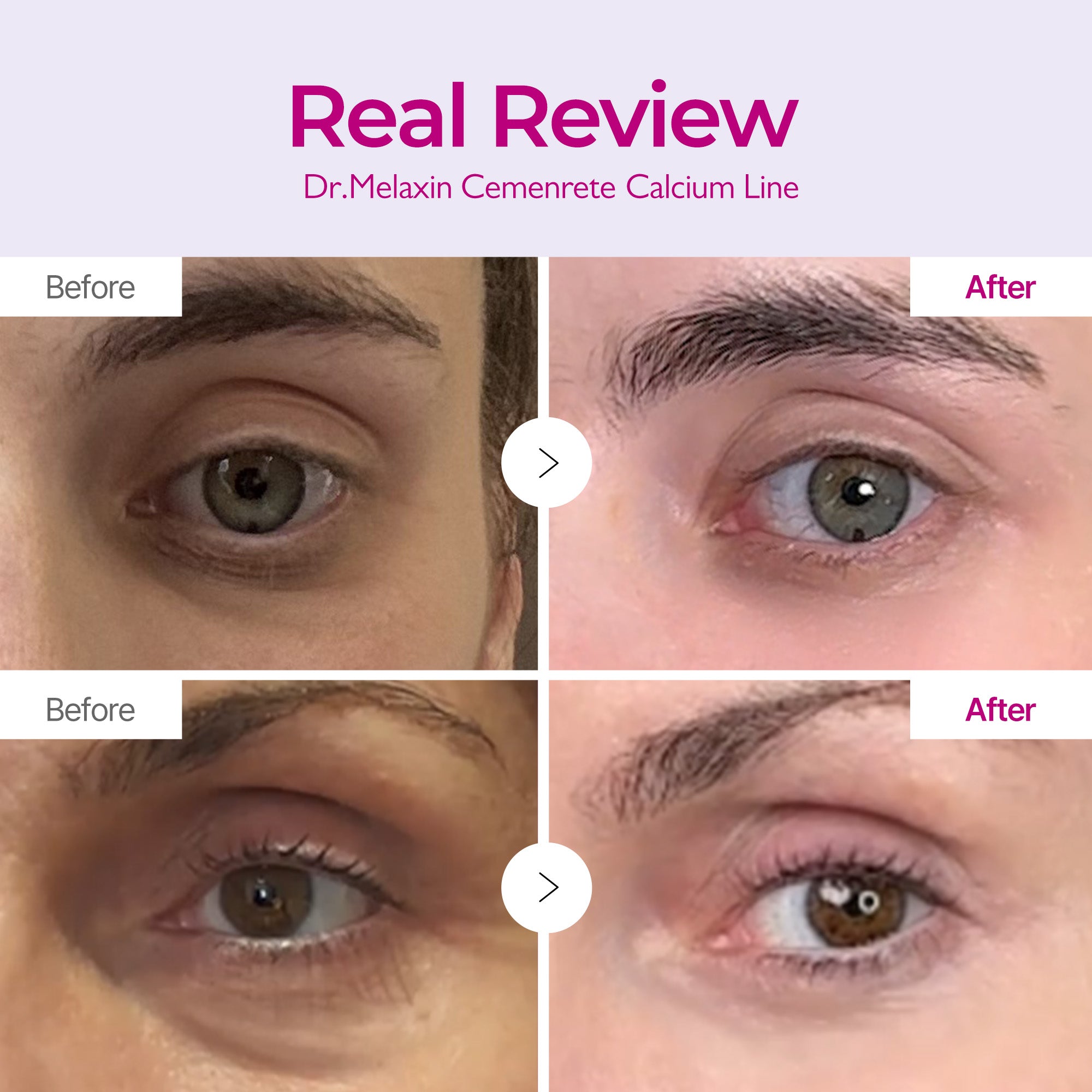 Cemenrete Calcium Eyecare Routine - Image 4